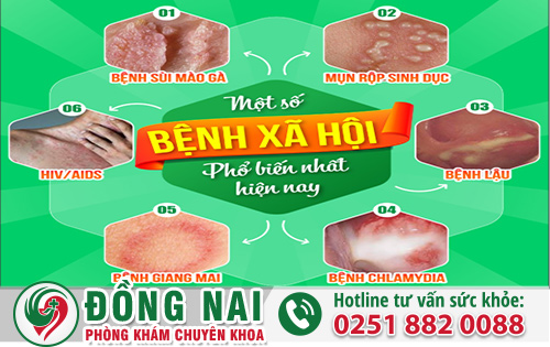 Những Triệu Chứng Nguy Hiểm Bệnh Xã Hội Anh Chị Nên Điều Trị Sớm