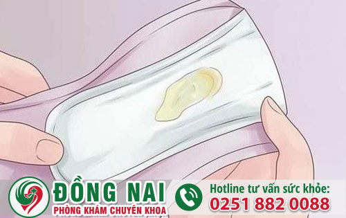 Âm đạo chảy mủ là bị gì?