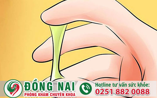 Âm Đạo Ra Mủ Ra Mủ , Dịch Có Phải Là Dấu Hiệu Bệnh Lậu