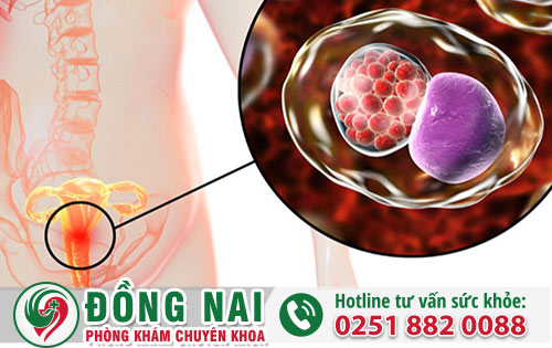 Bệnh lậu ở nữ giới có dấu hiệu gì?