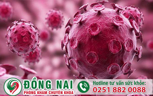 Bệnh mồng gà là bệnh gì?