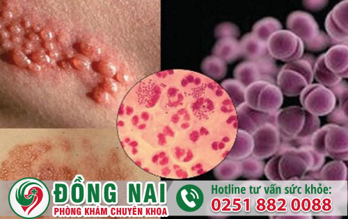 Bệnh quan hệ gồm những bệnh gì?