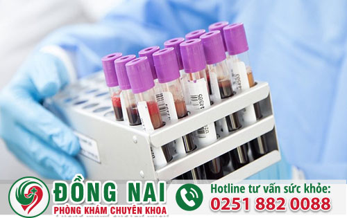 Các phương pháp xét nghiệm giang mai