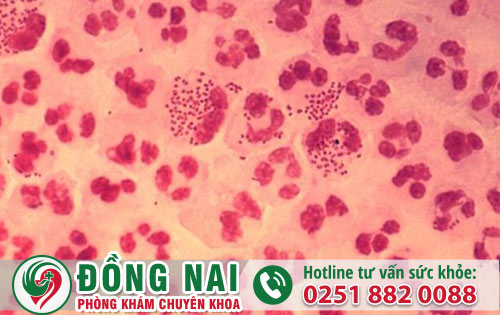 Chữa bệnh Lậu ở đâu hiệu quả và an toàn tại Đồng Nai?