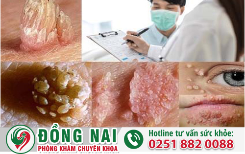 Phòng Khám Đa Khoa Hồng Phúc địa chỉ chữa sùi mào gà được nhiều người lựa chọn