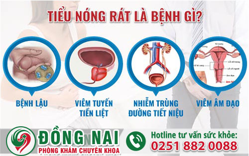 Đi tiểu ngứa rát là mắc bệnh gì? Hỗ trợ điều trị ra sao?