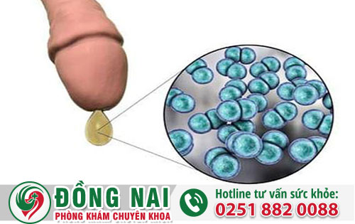 Dương vật chảy dịch do đâu và hướng khắc phục