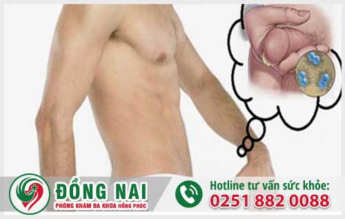 Dương vật chảy mủ có mùi hôi nguy cơ căn bệnh lậu