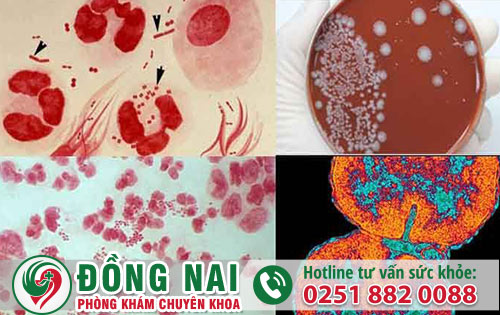 Lậu và những điều người bệnh cần biết