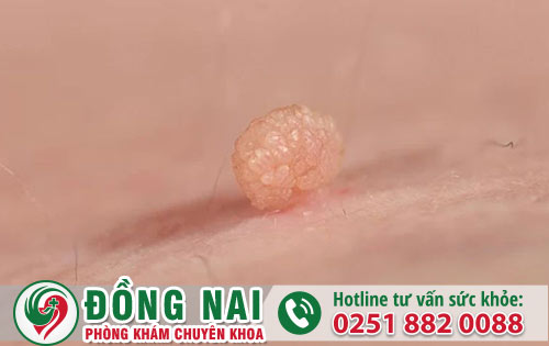Những Điều Bạn Cần Biết Về Thịt Thừa Vùng Kín
