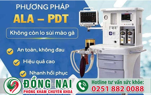 Phương pháp quang ALA-PDT hỗ trợ điều trị sùi mào gà có hiệu quả không?