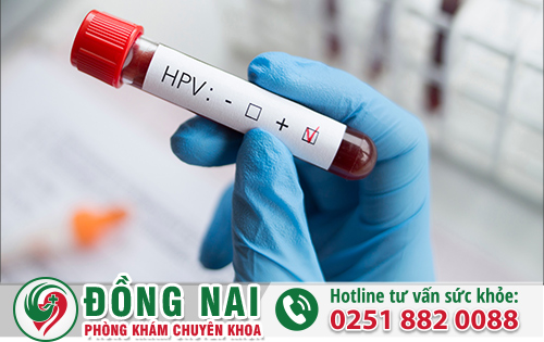 Phương Pháp Quy Trình Xét Nghiệm HPV Sùi Mào Gà Uy Tín