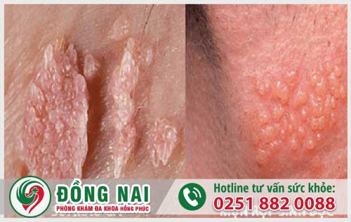 da khoa hong phuc