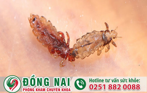 Rận mu là bệnh gì và hỗ trợ điều trị hiệu quả ở đâu?