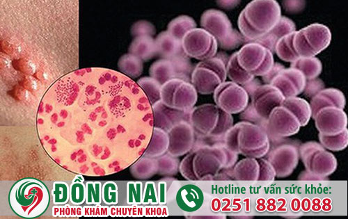 Tất tần tật những bệnh ở bộ phận sinh dục