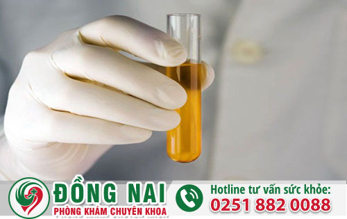 Tiểu ra dịch mủ ở nam và nữ nguyên nhân do đâu?