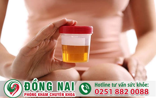 Tiểu ra mủ ở nữ giới là biểu hiện bệnh gì?