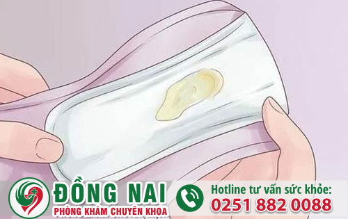 Vùng Kín Chảy Mủ Coi Chừng Mắc Bệnh Lậu