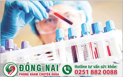 Xét Nghiệm Bệnh Xã Hội Chẩn Đoán Chính Xác Tại Biên Hòa