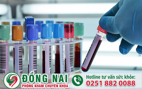 Xét nghiệm bệnh xã hội mang đến những lợi ích gì?